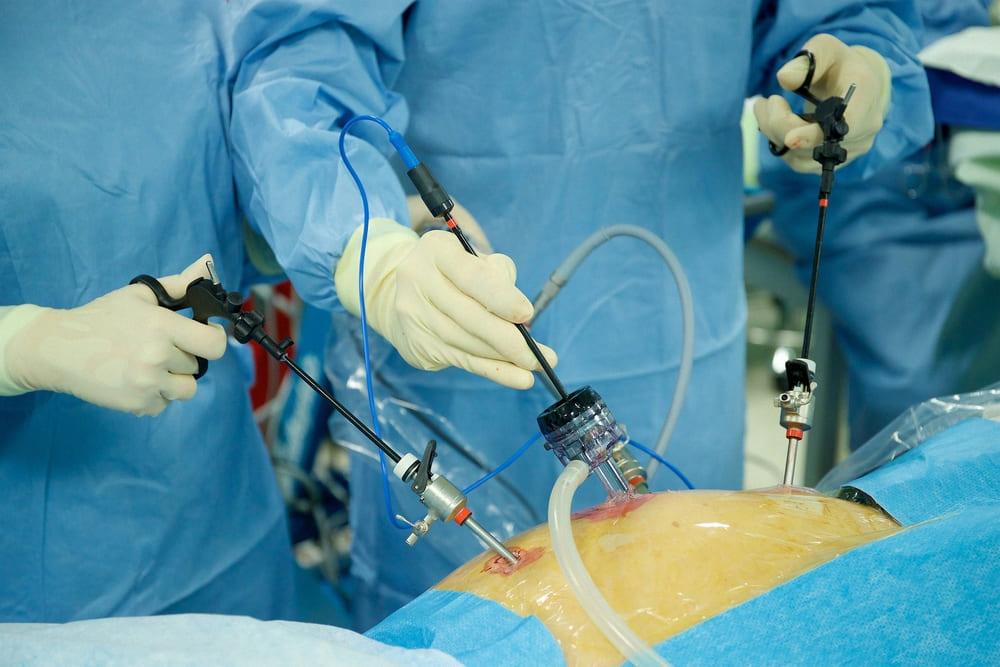 Endoscopic Submucosal Dissection (ESD) Technique